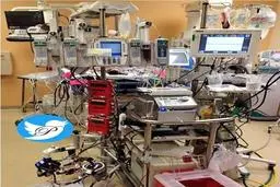  نمونه‌ای از دستگاه ECMOتراپی