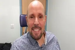 
 پیوند چشم مصنوعی با پرینت سه بعدی برای اولین بار در جهان
