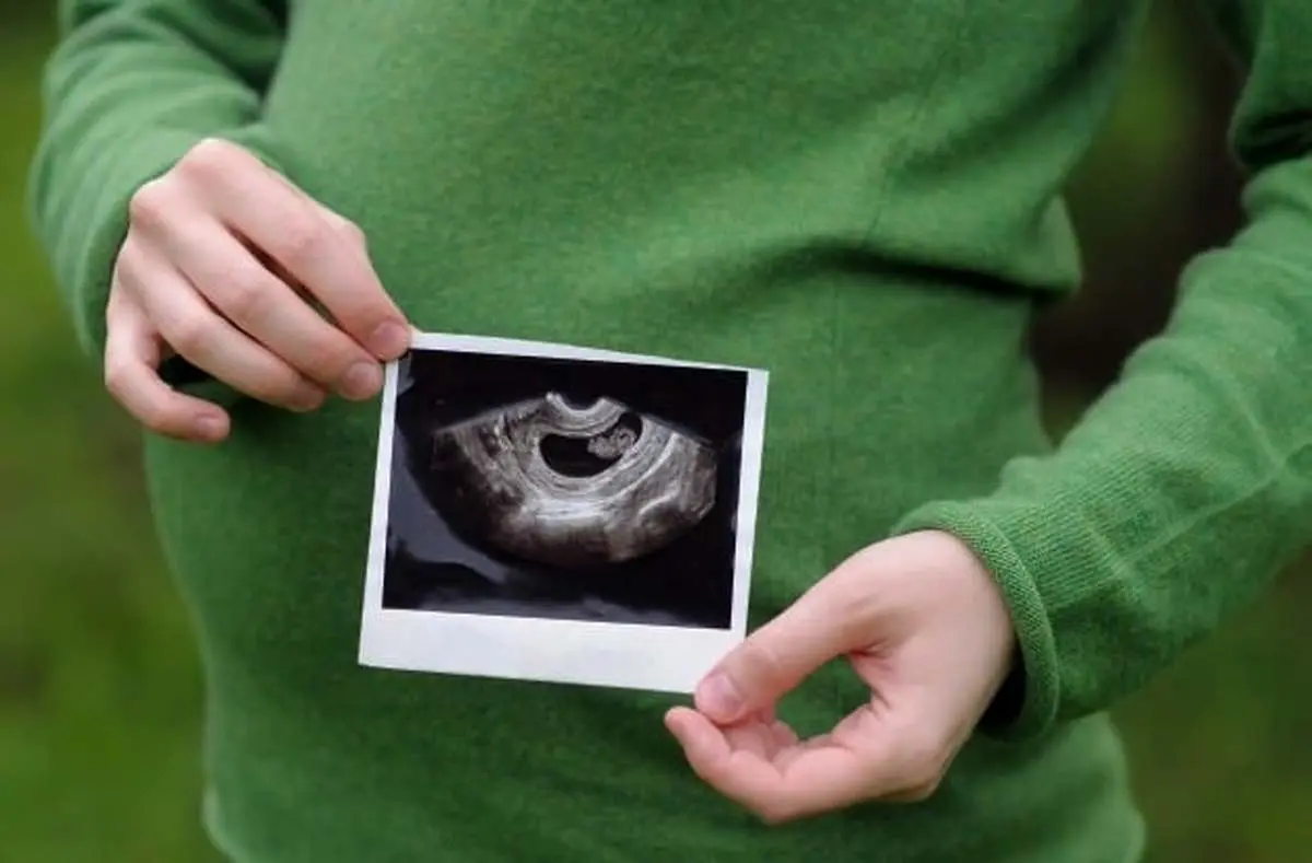 وضعیت جنین و مادر در هفته 29 بارداری