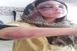 خشونت علیه زنان| مژگان از همسر هشتادوسه ساله اش طلاق می‌خواهد