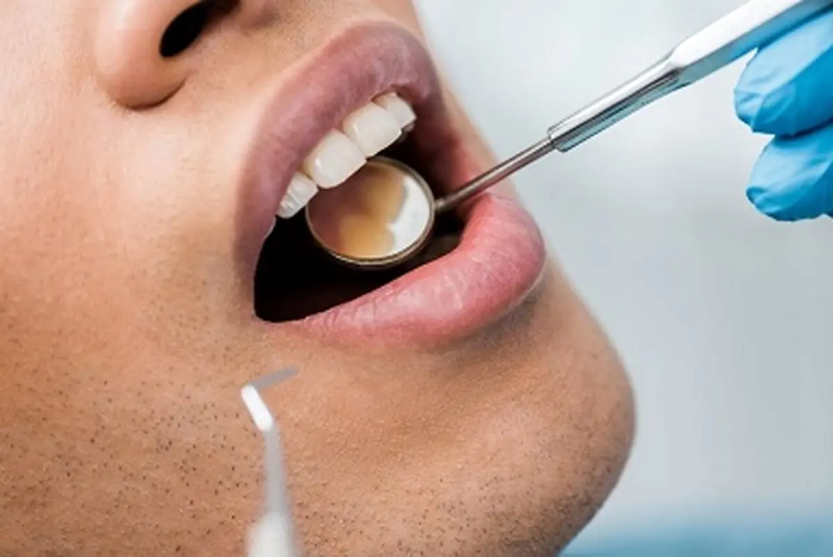 کرونا به دندان‌ها هم آسیب می زند | دندانپزشکی‌های تعطیل هم به سلامت دندان‌ها آسیب رساندند