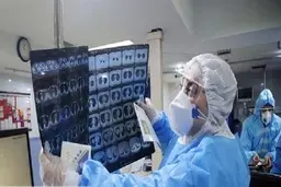 
دانشگاه علوم پزشکی البرز: سی.تی.اسکن در تشخیص دقیق کرونا کافی نیست