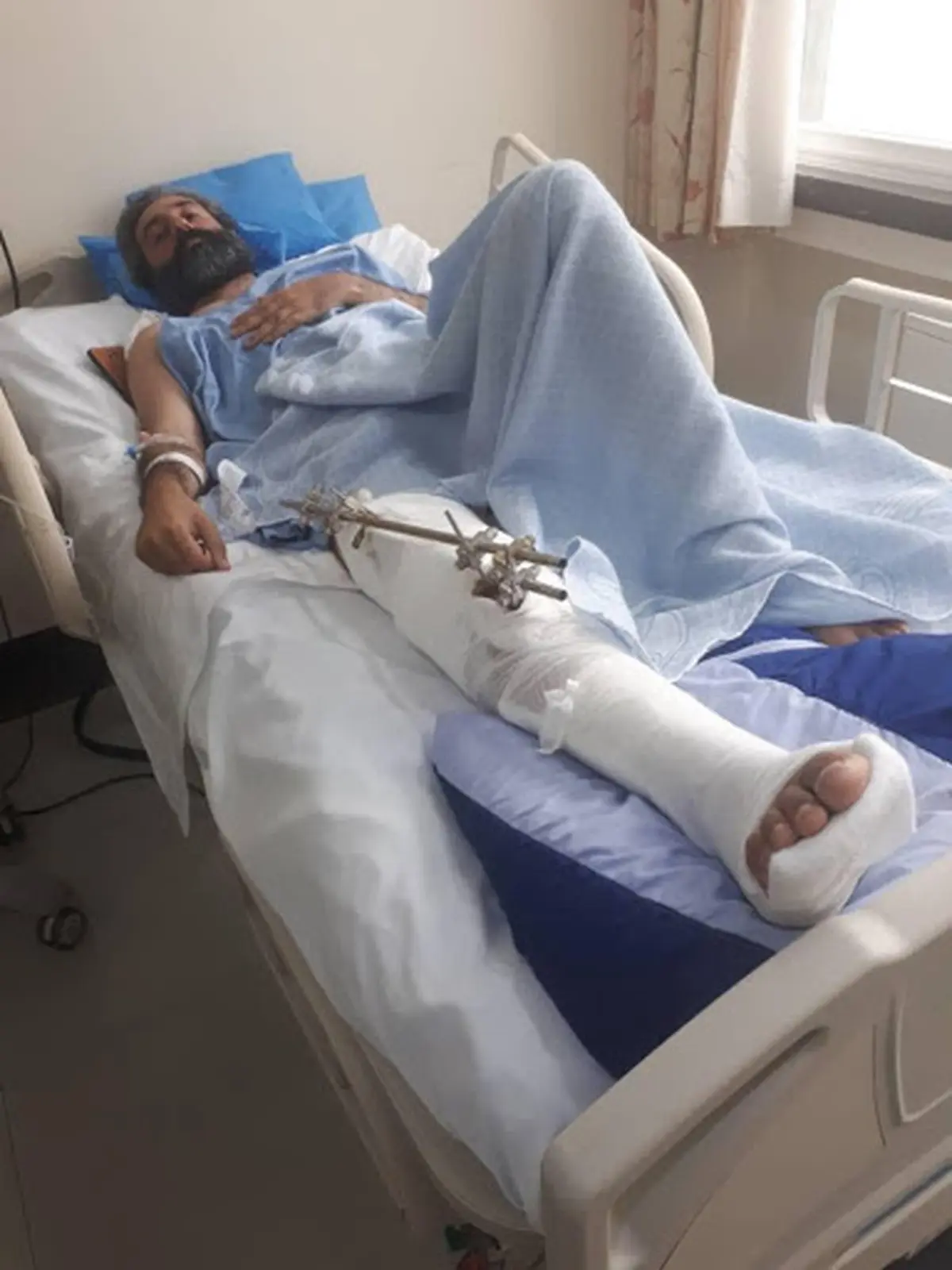  مردم  و فعالان نگران قطع پای محیط بان خوزستانی هستند