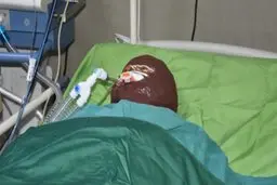 ماجرای اسیدپاشی به سیما افشاری | پیشنهاد‌های بی‌شرمانه به قربانی اسیدپاشی