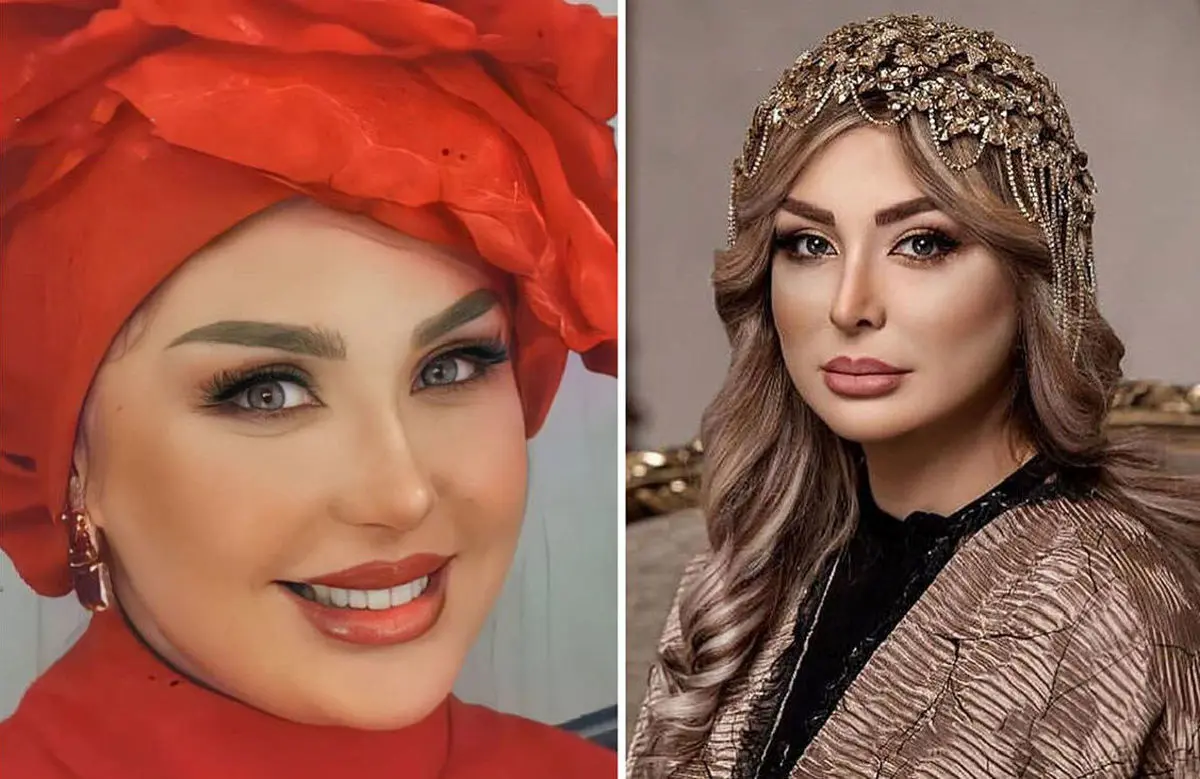نیوشا ضیغمی توسط دکترها ملکه زیبایی ایران شد ! + عکس 