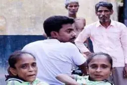 ازدواج خواهران از شکم به هم چسبیده با یک مرد! +تصاویر