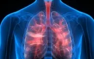 گزارش شیوع نوعی بیماری تنفسی در کالیفرنیا