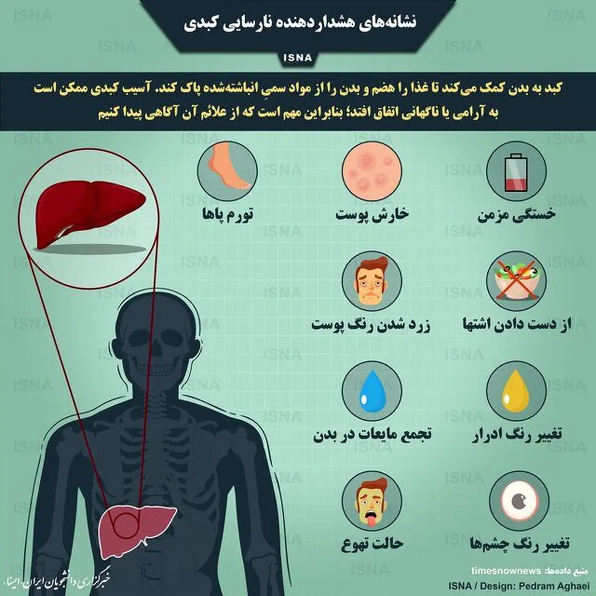 نشانه‌های هشداردهنده نارسایی کبدی را بشناسید