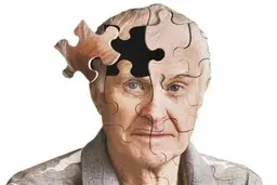 علائم هشدار دهنده بیماری آلزایمر