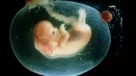 اعلام جزئیات دستورالعمل سقط جنین | سن مجاز برای صدور مجوز سقط چهار ماه قمری است