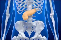 تاثیر جراحی کاهش وزن در پایین آمدن ریسک سرطان لوزالمعده