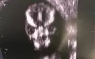 وحشت مادر از عکس سونوگرافی جنین داخل شکمش+تصویر
