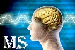 بهترین روش برای کنترل ام‌اس چیست ؟