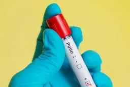 شیوع ویروس فلج اطفال | اعلام وضعیت اضطراری و شوک بزرگ به مردم