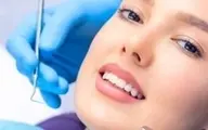 مواردی که برای دندان هایتان مضر هستند را بشناسید