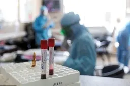 آمریکا در تعداد مبتلایان به کرونا از چین پیشی گرفت 
