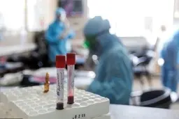 آمریکا در تعداد مبتلایان به کرونا از چین پیشی گرفت 
