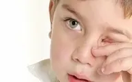 دستمالی کودکان با چشمانشان را جدی بگیرید| کرونا در کمین چشمان کودکان
