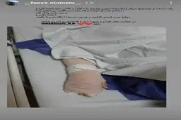 کتک زدن و شکستن  دست یک خبرنگار توسط حراست دانشگاه علوم پزشکی شهید بهشتی