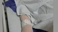 کتک زدن و شکستن  دست یک خبرنگار توسط حراست دانشگاه علوم پزشکی شهید بهشتی