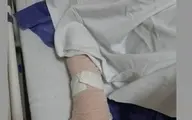 کتک زدن و شکستن  دست یک خبرنگار توسط حراست دانشگاه علوم پزشکی شهید بهشتی