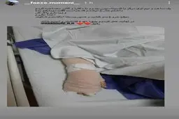 کتک زدن و شکستن  دست یک خبرنگار توسط حراست دانشگاه علوم پزشکی شهید بهشتی
