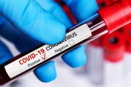 وام کرونا| کدام کشورها وام کرونایی گرفتند؟