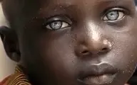چشم های این پسر آفریقایی جهان را مبهوت خود کرد! |‌ داستان او+ ویدئو