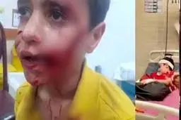 مرگ دلخراش کودک ۱۱ ساله مسجدسلیمانی بر اثر حمله سگ‌های ولگرد | زنگ خطر جدی معضل سگ‌های رهاشده در شهرها