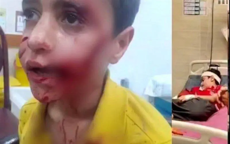 مرگ دلخراش کودک ۱۱ ساله مسجدسلیمانی بر اثر حمله سگ‌های ولگرد | زنگ خطر جدی معضل سگ‌های رهاشده در شهرها
