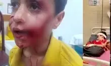 مرگ دلخراش کودک ۱۱ ساله مسجدسلیمانی بر اثر حمله سگ‌های ولگرد | زنگ خطر جدی معضل سگ‌های رهاشده در شهرها