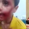 مرگ دلخراش کودک ۱۱ ساله مسجدسلیمانی بر اثر حمله سگ‌های ولگرد | زنگ خطر جدی معضل سگ‌های رهاشده در شهرها