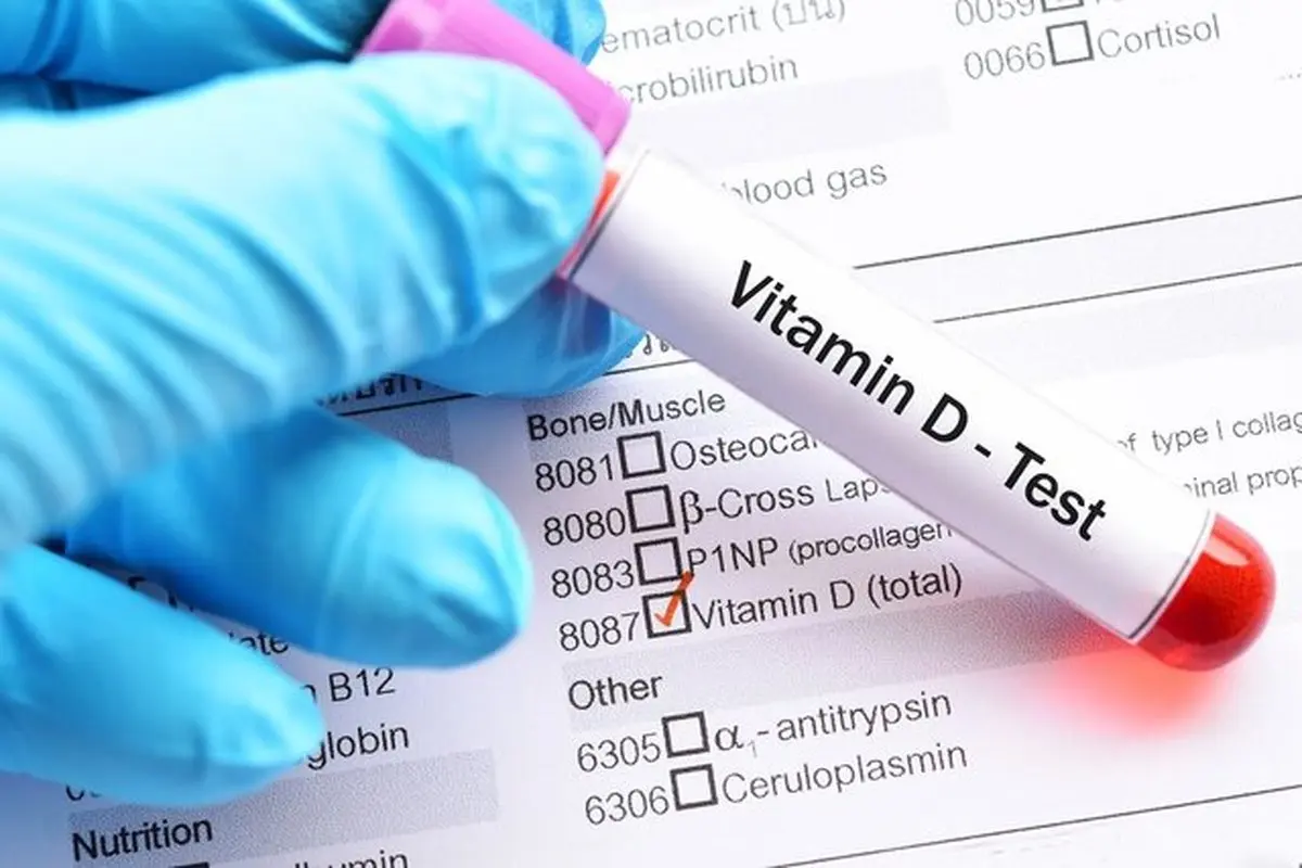 نقش ویتامین D‌ بر شدت بیماری و مرگ‌ومیر کووید ۱۹ | مصرف خودسرانه ممنوع! 