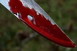 کل کل اینستاگرامی دست مرد جوان را قطع کرد +ویدئو