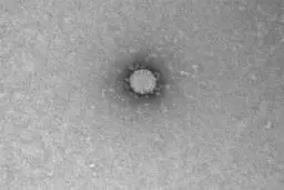 تصاویر جدید از ویروس کرونا پس از کشف دانشمندان روسی