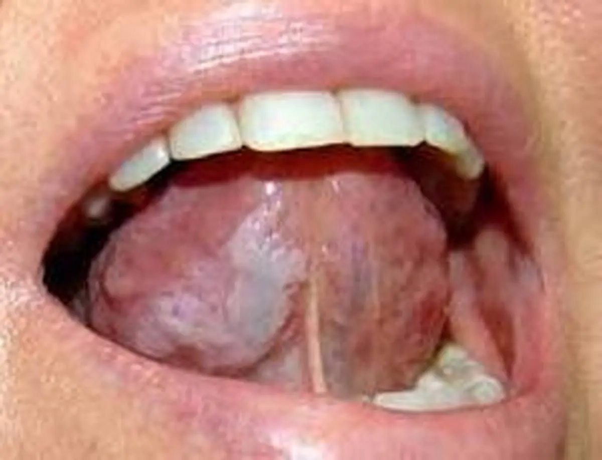 تشخیص مشکل دستگاه گوارش از راه دهان