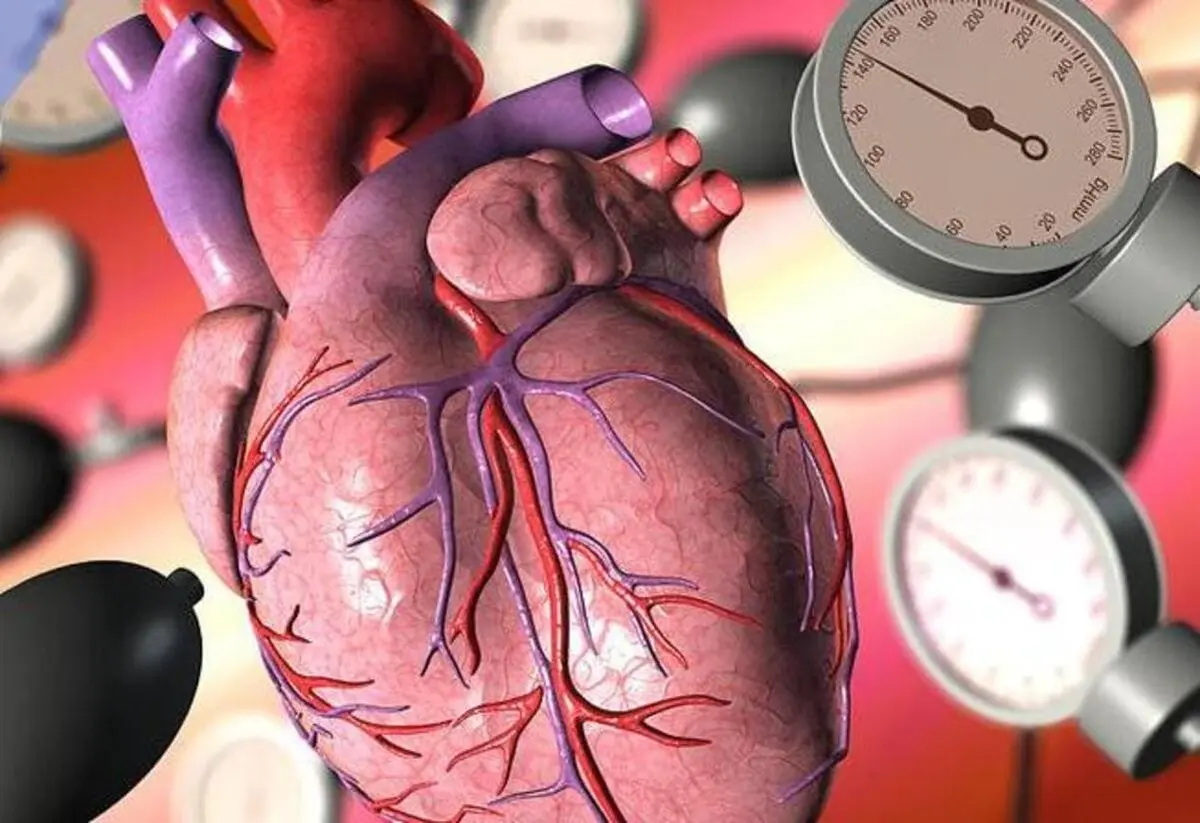 چگونه بدون دستگاه فشار بفهمیم فشار خونمان بالا است؟