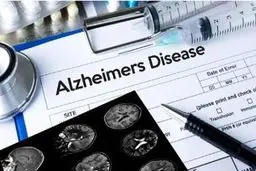 تلاش دانشمندان برای کشف رابطه میان کرونا با آلزایمر 
