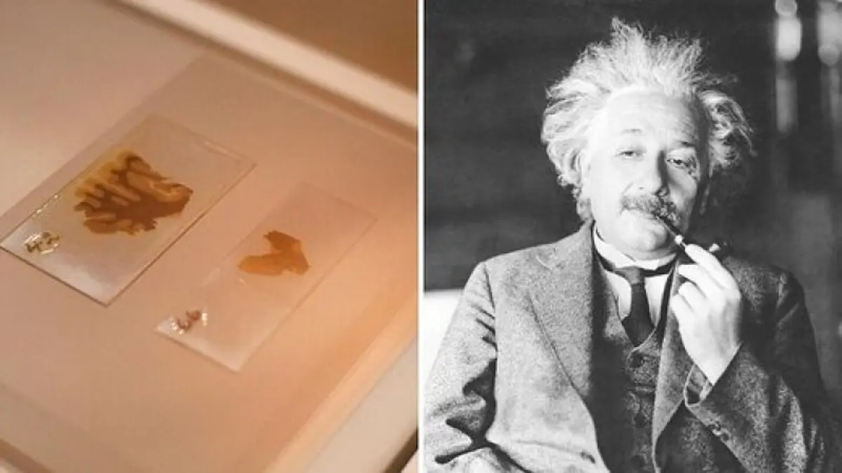 ماجرای عجیب دزدی مغز اینشتین توسط یک پزشک+ عکس