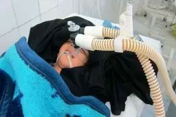 عقرب گزیدگی دلیل مرگ تراژیک مادر ۲۷ ساله و کودک ۲ و نیم ساله اندیکایی