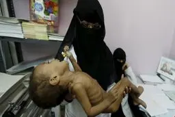 روآوردن  یمنی‌ها از روی فقر به گدایی، کار و ازدواج کودکان