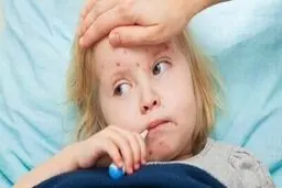 بیماری کاوازاکی وکرونا از هم جدا هستند و هیچ ربطی به هم ندارند.