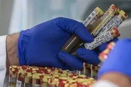 ۲۸ تست دوپینگ از بازیکنان فوتبال در یک ماه اخیر 