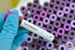 آماده باش مرزهای غربی برای جلوگیری از ورود کرونا