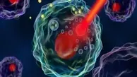 لیزر و نانومواد، سلاحی جدید در مبارزه با سرطان
