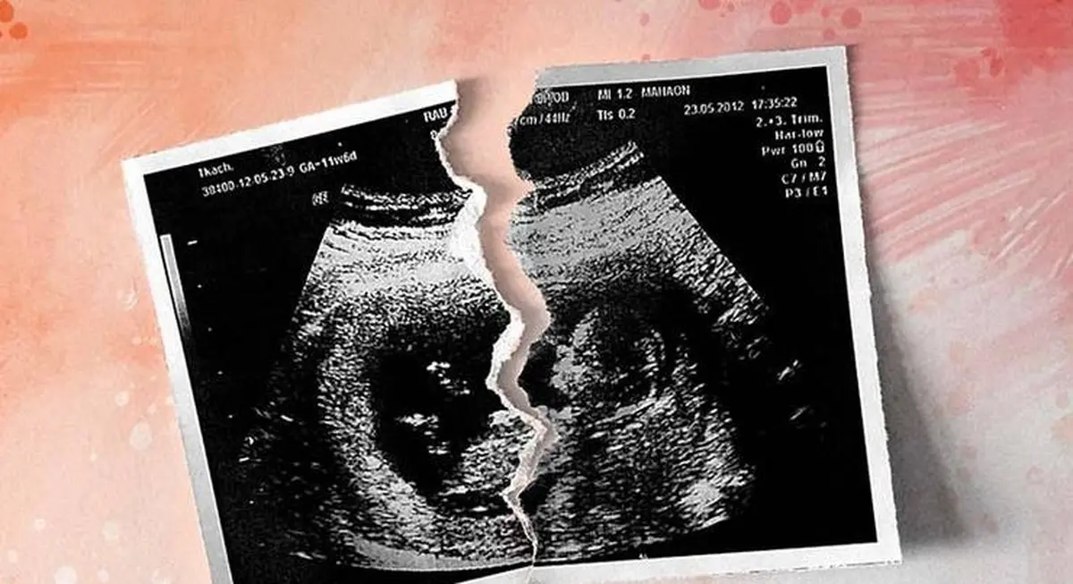 دبیر مرکز مطالعات راهبردی جمعیت: سالانه ۴۰۰ هزار جنین در کشور سقط می‌شود؛ ۹۶ درصد آنها غیرقانونی است