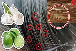 چگونه شپش سر را ریشه کن کنیم؟ | از تمیز کردن خانه غافل نشوید!
